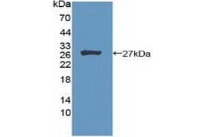 Detection of Recombinant MEN1, Human using Polyclonal Antibody to Menin (MEAI) (Menin anticorps  (AA 219-395))