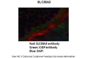 Primary Antibody Dilution :  1:200  Secondary Antibody :   Goat anti-rabbit Alexafluor 568  Secondary Antibody Dilution :  1:200  Color/Signal Descriptions :  SLC38A3: Red CtBp: Green DAPI: Blue  Gene Name :  SLC38A3  Submitted by :  Anonymous