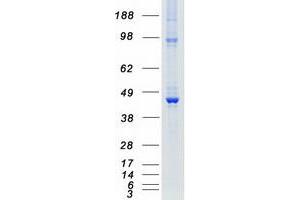 Validation with Western Blot