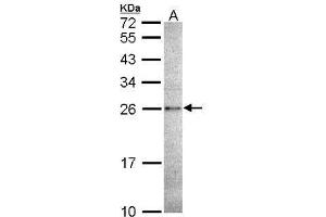 WB Image Sample (30 ug of whole cell lysate) A: A431 , 12% SDS PAGE antibody diluted at 1:1000 (CASP14 anticorps  (C-Term))