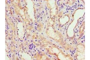 Immunohistochemistry of paraffin-embedded human kidney tissue using ABIN7143650 at dilution of 1:100 (ADH4 anticorps  (AA 1-380))