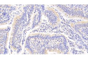 Detection of PTPN22 in Human Small intestine Tissue using Polyclonal Antibody to Protein Tyrosine Phosphatase, Non Receptor Type 22 (PTPN22)