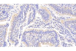Detection of PTPN22 in Human Small intestine Tissue using Polyclonal Antibody to Protein Tyrosine Phosphatase, Non Receptor Type 22 (PTPN22) (PTPN22 anticorps  (AA 1-233))
