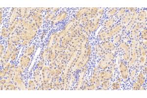 Detection of HMWK in Human Kidney Tissue using Polyclonal Antibody to High Molecular Weight Kininogen (HMWK)