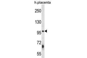 ZFYVE1 Antibody (N-term) western blot analysis in human placenta tissue lysates (35 µg/lane). (ZFYVE1 anticorps  (N-Term))