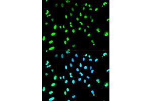 Immunofluorescence analysis of HeLa cells using TARDBP antibody.