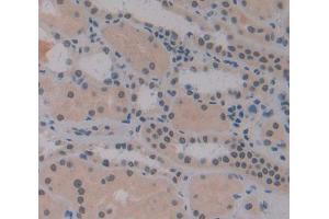 Used in DAB staining on fromalin fixed paraffin- embedded Kidney tissue