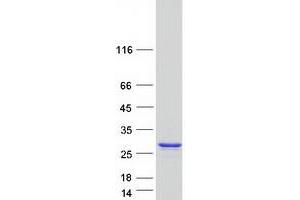 Validation with Western Blot