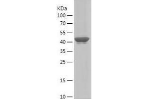 Western Blotting (WB) image for Myosin Heavy Chain 1, Skeletal Muscle, Adult (MYH1) (AA 449-651) protein (His-IF2DI Tag) (ABIN7124057)