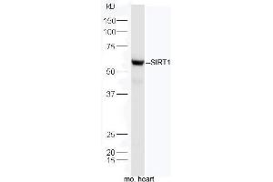 Protein: mouse heart lysate;  Primary: rabbit Anti-SIRT1  at 1: 5000;  Predicted band size: 58/81 kD Observed band size: 58 kD (SIRT1 anticorps  (AA 101-200))