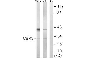 Immunohistochemistry analysis of paraffin-embedded human colon carcinoma tissue, using CBR3 antibody. (CBR3 anticorps)