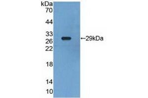 Detection of Recombinant RXRg, Human using Polyclonal Antibody to Retinoid X Receptor Gamma (RXRg) (Retinoid X Receptor gamma anticorps  (AA 12-220))