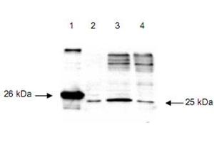 Immunoblot using DIABLO polyclonal antibody  detects a 26 kDa band when 1 ug of recombinant DIABLO is applied (lane 1). (DIABLO anticorps  (AA 56-239))