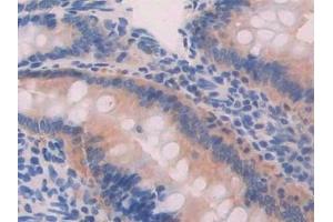 Detection of PFKP in Rat Small intestine Tissue using Polyclonal Antibody to Phosphofructokinase, Platelet (PFKP)