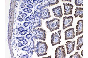 IHC analysis of Cytochrome P450 2D6 using anti- Cytochrome P450 2D6 antibody .