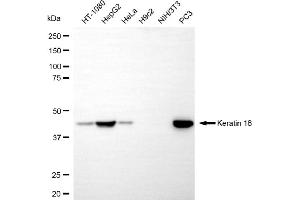 Western blotting analysis using keratin 18 antibody (ABIN7799173).