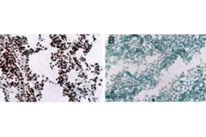MyoD Immunohistochemistry.