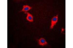 Immunofluorescent analysis of Beta-synuclein staining in HeLa cells. (beta Synuclein anticorps  (C-Term))