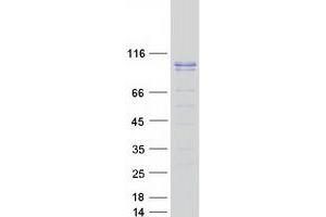 Validation with Western Blot
