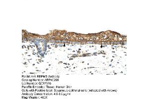 Rabbit Anti-RBPMS Antibody  Paraffin Embedded Tissue: Human Skin Cellular Data: Squamous epithelial cells Antibody Concentration: 4.