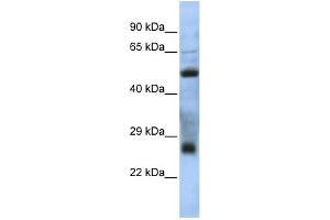 WB Suggested Anti-MGC26647 Antibody Titration: 0.