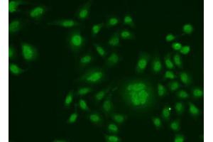 Immunofluorescence analysis of HeLa cells using ERCC1 antibody.