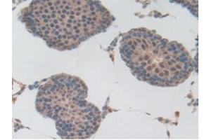 IHC-P analysis of Rat Testis Tissue, with DAB staining. (PLG anticorps  (AA 191-433))