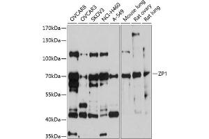 Western blot analysis of extracts of various cell lines, using ZP1 antibody (ABIN6130973, ABIN6150532, ABIN6150533 and ABIN6214972) at 1:1000 dilution. (ZP1 anticorps  (AA 340-610))