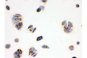 IHC analysis of ERAB using anti-ERAB antibody .