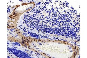 Immunohistochemistry analysis of paraffin-embedded mouse spleen using TAGLN Polyclonal Antibody at dilution of 1:400.