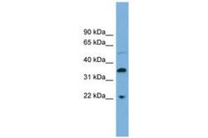 Image no. 1 for anti-Docking Protein 6 (DOK6) (C-Term) antibody (ABIN6745096) (DOK6 anticorps  (C-Term))