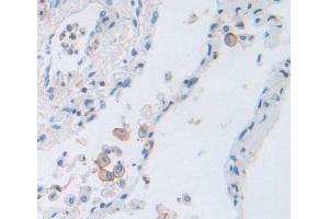 Used in DAB staining on fromalin fixed paraffin- embedded Kidney tissue (PCDH20 anticorps  (AA 64-209))