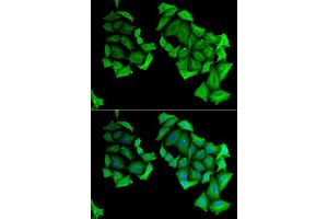 Immunofluorescence analysis of HeLa cell using C4BPB antibody. (C4BPB anticorps)