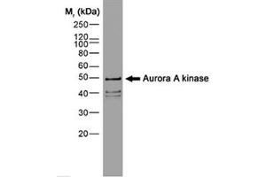 Image no. 1 for anti-Aurora Kinase A (AURKA) (N-Term) antibody (ABIN206445) (Aurora A anticorps  (N-Term))