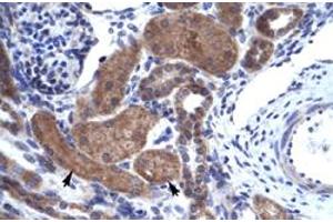 Immunohistochemical staining (Formalin-fixed paraffin-embedded sections) of human kidney with IKZF2 polyclonal antibody  at 4-8 ug/mL working concentration.