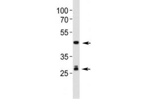 Western blot analysis of lysate from mouse liver tissue lysate using Shh antibody.