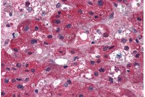 Human Adrenal (formalin-fixed, paraffin-embedded) stained with ARIH1 antibody ABIN337340 at 5 ug/ml followed by biotinylated anti-goat IgG secondary antibody ABIN481715, alkaline phosphatase-streptavidin and chromogen. (ARIH1 anticorps  (AA 513-526))