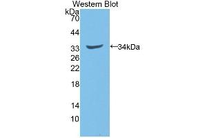Detection of Recombinant NQO1, Rat using Polyclonal Antibody to NADH Dehydrogenase, Quinone 1 (NQO1)