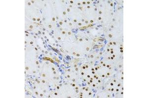 Immunohistochemistry of paraffin-embedded mouse kidney using SNRNP70 antibody.