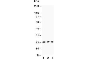 Western blot testing of TNFb antibody and Lane 1:  HeLa;  2: MCF-7;  3: COLO320