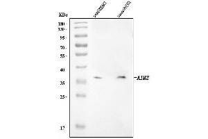 Western blot analysis of Aim2 using anti-Aim2 antibody (ABIN7599984).