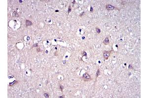 Immunohistochemical analysis of paraffin-embedded human brain tissues using MMP9 monoclonal antibody, clone 5G3  with DAB staining.