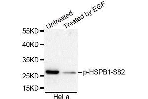 Western Blotting (WB) image for anti-Heat Shock 27kDa Protein 1 (HSPB1) (pSer82) antibody (ABIN3023550) (HSP27 anticorps  (pSer82))