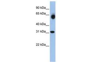 Image no. 1 for anti-Dehydrogenase/reductase (SDR Family) Member 2 (DHRS2) (AA 108-157) antibody (ABIN6740754) (DHRS2 anticorps  (AA 108-157))