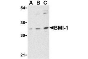 Western blot analysis of BMI-1 in K562 cell lysate with AP30158PU-N BMI-1 antibody at (A) 0. (BMI1 anticorps  (Intermediate Domain))