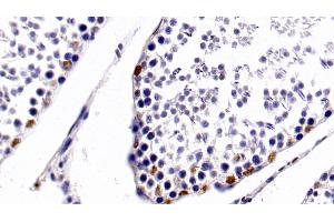 Detection of HDAC1 in Rat Testis Tissue using Monoclonal Antibody to Histone Deacetylase 1 (HDAC1)