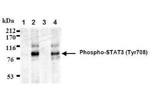 Western Blotting (WB) image for anti-Signal Transducer and Activator of Transcription 3 (Acute-Phase Response Factor) (STAT3) (AA 703-714), (pTyr705), (pTyr708) antibody (ABIN1449165) (STAT3 anticorps  (pTyr705, pTyr708))