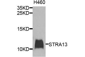 Western blot analysis of extracts of H460 cells, using STRA13 antibody. (STRA13 anticorps)