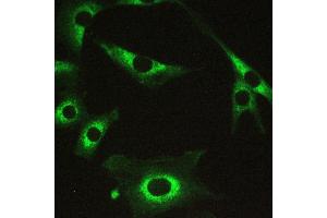 IHC analysis of PPP1R12A using anti-PPP1R12A antibody . (PPP1R12A anticorps  (N-Term))