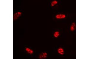 Immunofluorescent analysis of Histone H2B (AcK15) staining in Hela cells.